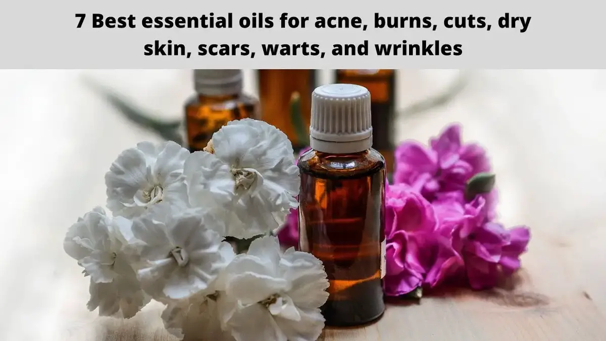 'Video thumbnail for 7 Best essential oils for acne, burns, cuts, dry skin, scars, warts, and wrinkles'