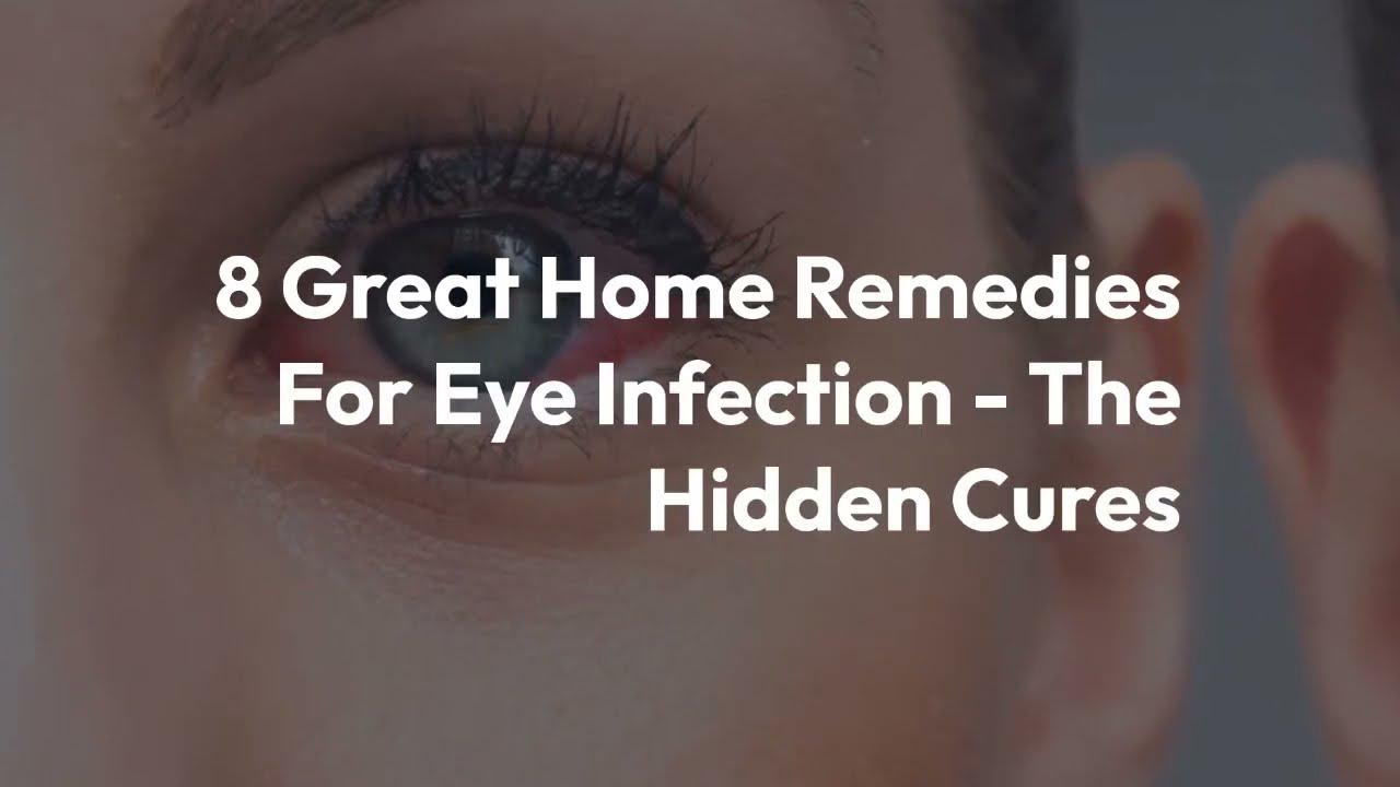 'Video thumbnail for 8 Great Home Remedies For Eye Infection'