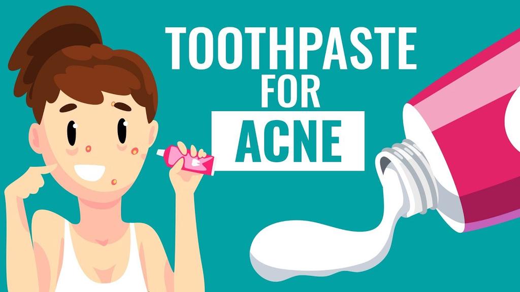 'Video thumbnail for Is Using Toothpaste For Acne safe? || Know the Truth'