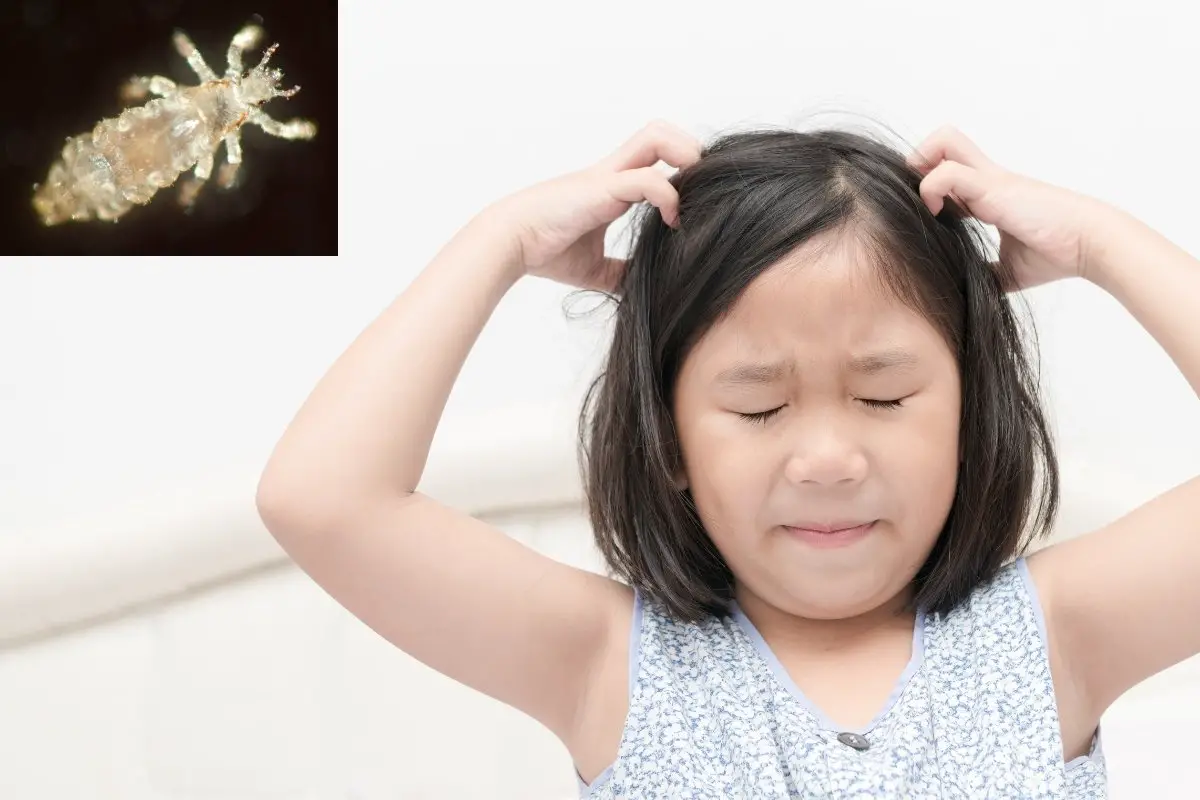 How to Use Diatomaceous Earth for Head Lice