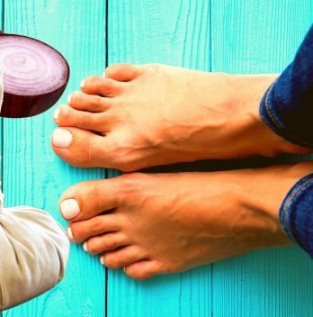 Can You Use Onion Poultice on Feet