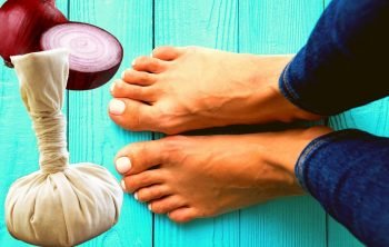 Can You Use Onion Poultice on Feet