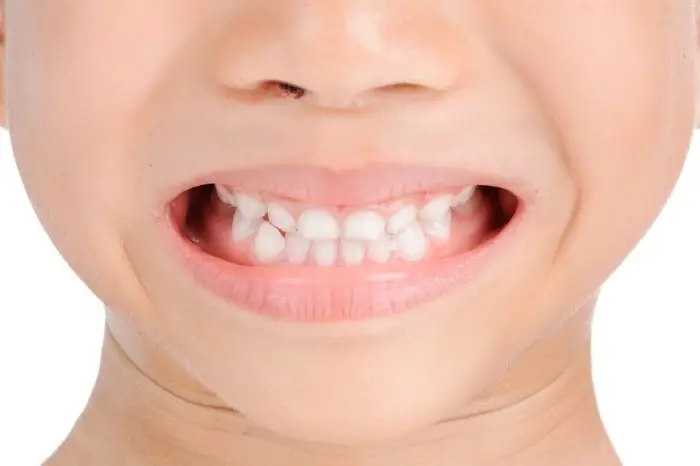 Whiter And Brighter Tooth