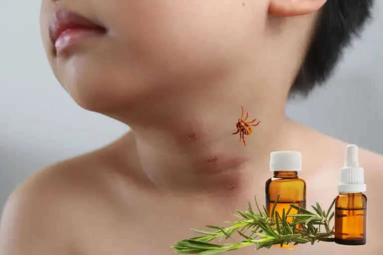 The Best Essential Oils For Chigger Bites