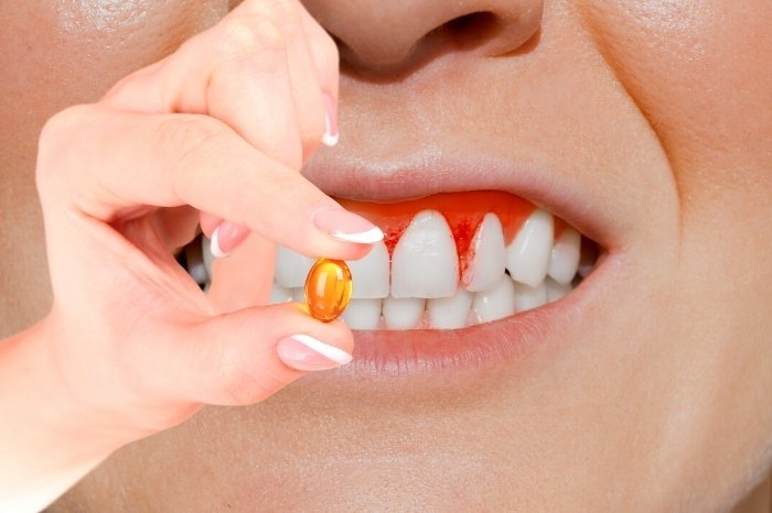 Cod Liver Oil for Cavities and Gums