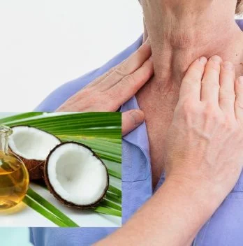 Is Coconut Oil Good For Thyroids