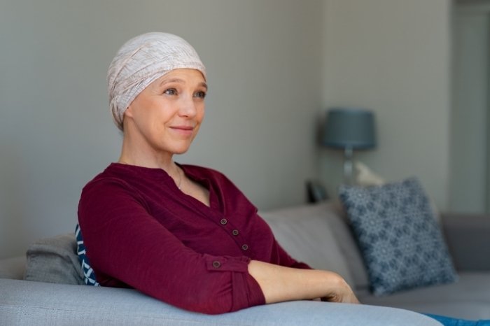 Radiation Therapy Hair Loss