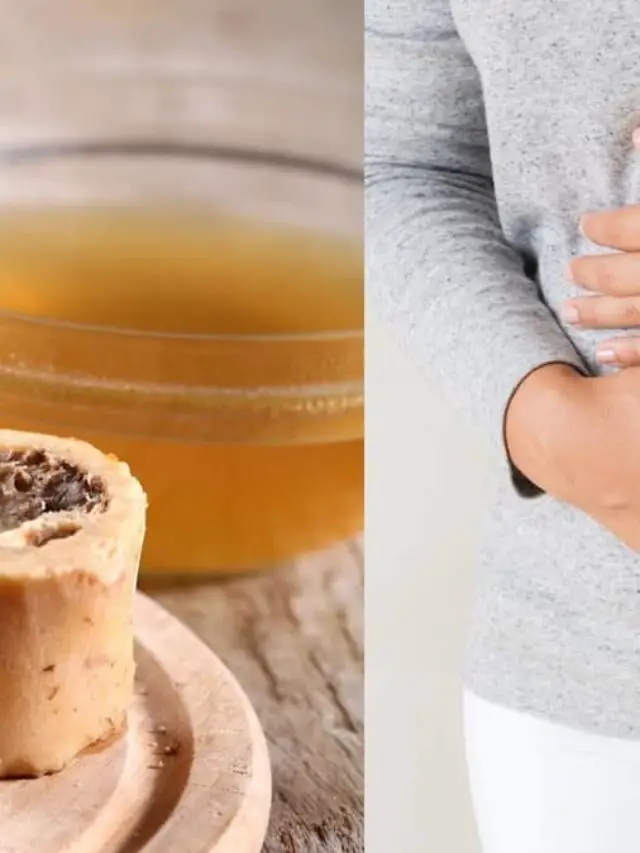 How To Properly Use Bone Broth For Stomach Ulcers