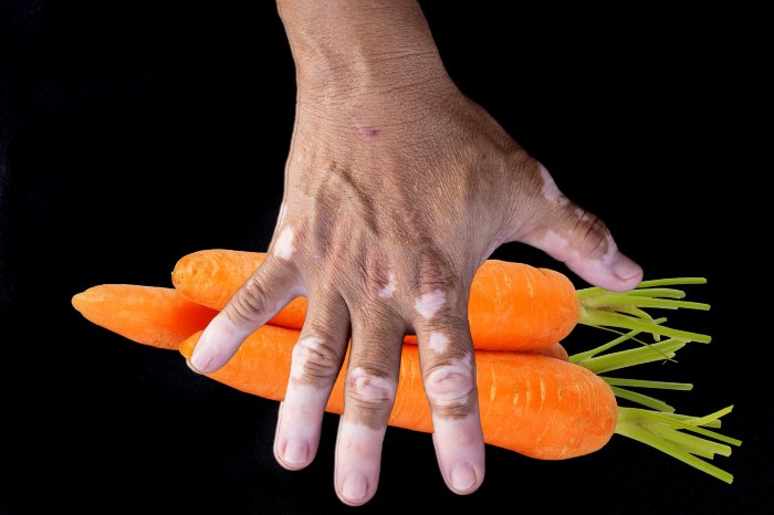 Does Carrot Increase Melanin